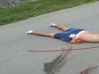 What a Lady Body Looks Like when Her Guts are Pushed Out through Her Stomach