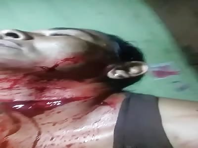 Woman Slices Her Neck Open With Razor Blade