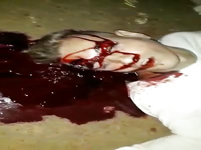 Gasping Blood Gurgling Moments After Being Shot in the Head 