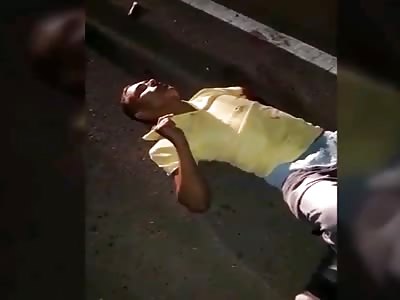 People Still Alive are Mangled Like Raw Meat