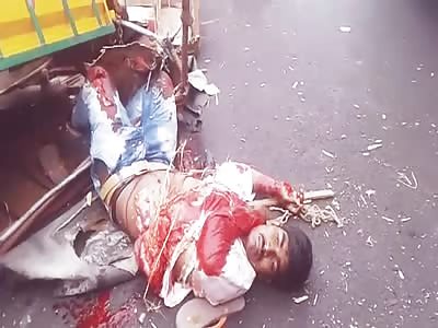  In Shock with Guts Exposed.