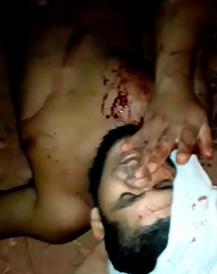 Man Received Chop Up from Angry Guy with Machete