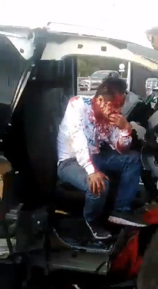 That's Gonna Leave a Horrible Scar