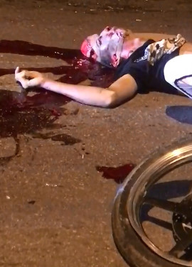 Best Friends Left in Shreds After Accident