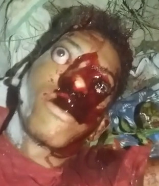 Ever Seen an Eye Seep out of a Head ... Getting Shot Will Do It