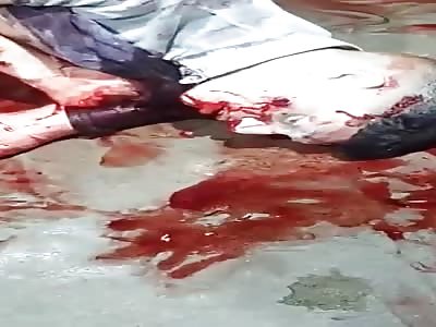 Wtf: Shocking man in terrible agony after gets shots