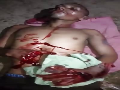 Brutal, man attacked with machete