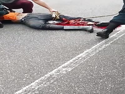 Leg destroyed in accident.