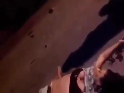 Wrecked foot in accident