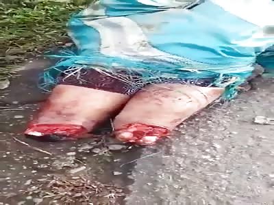 Woman Found Dismembered