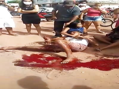 Shattered leg after accident