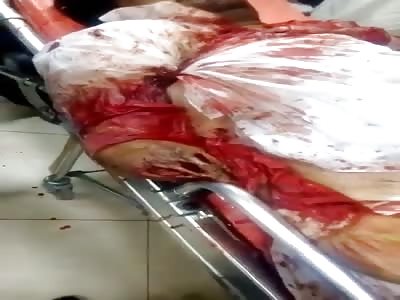 man killed with machete attack