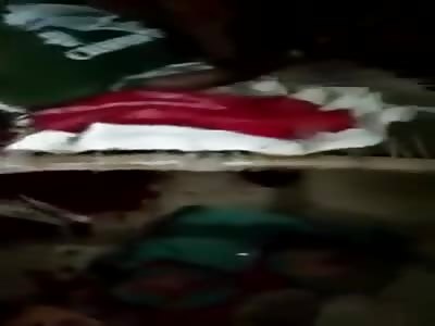 victim of terrible accident in agony