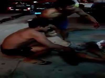 help me , please man  have leg cuted