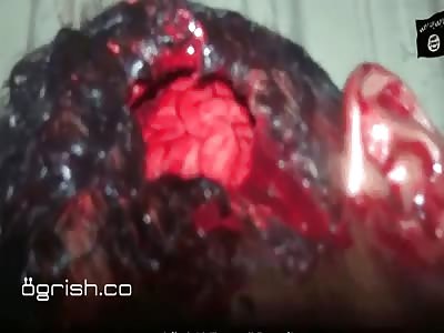 Lopped Off Head, Brains Showing