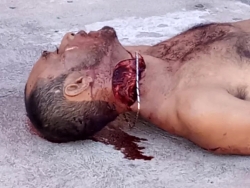 Murdered man on the street