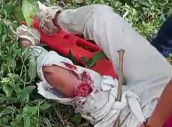 Couple on motorcycle injured after brutal accident 