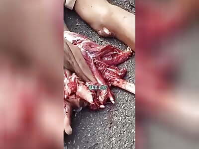 Motociclis ta with shattered leg in accident 