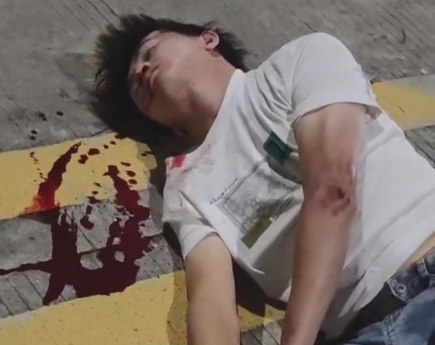 Two Chinese young man on motorcycle crushed by female driver