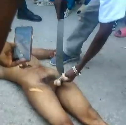 This Is How Castration Looks Like In Haiti