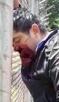 Face Destroyed in Accident