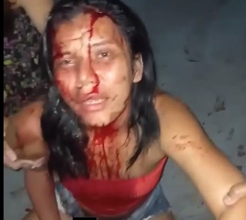 Woman Beaten by her Husband...