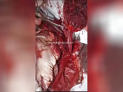 CITY OF KHARKIV IN THREE DAYS(c)