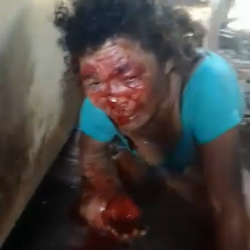 Poor Woman Suffers Terrible Pain After Machete Attack By Own Husband