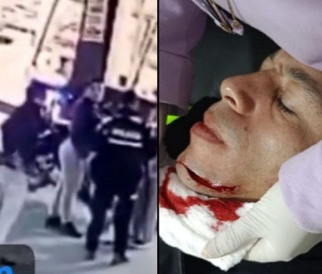 Drunk man slashed police officer face with knife 