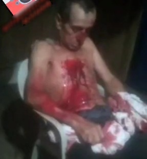 Ecuadorian Farmer attacked by wild animal 