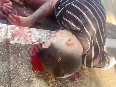 2 People Get Found Killed In Shooting In Front Of Medical Center In Brazil