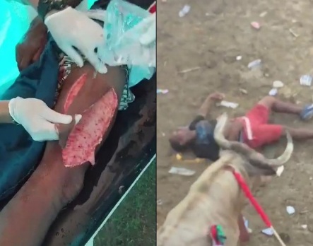 Horrific leg injury after bull attack 