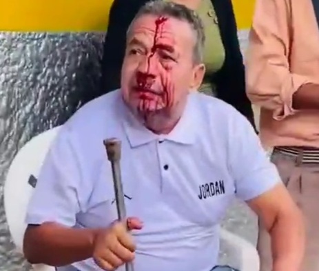 CITIZEN WAS SERIOUSLY INJURED for RESISTING a robbery