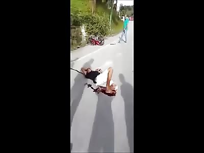 Man With Busted Knee Cap After an Accident 