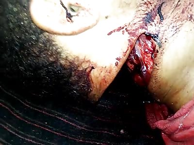 Man Killed in Machete Attack Lying in Coffin All Set for Burial