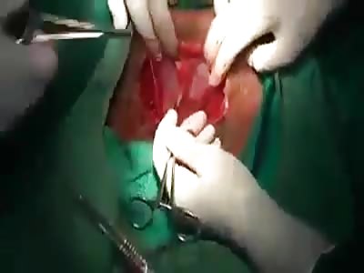Caesarean Section