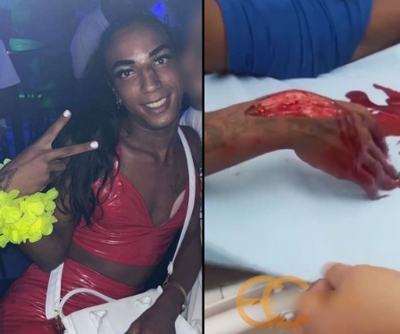 Tranny victim of machete attack 
