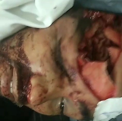 [EMPTY SKULL]drug dealer killed,had part of his head torn off by a rifle shot