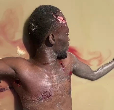 [CRACKED SKULL]Haitian young man killed by gangsters 