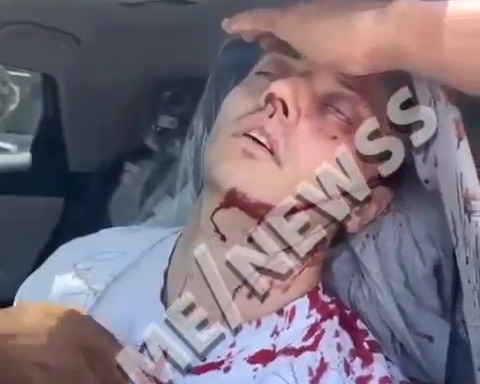 Israeli young man driving his car wounded by rocket from Hezbollah 