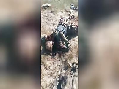 Survivors of Ukrainian special forces (Part-2). 