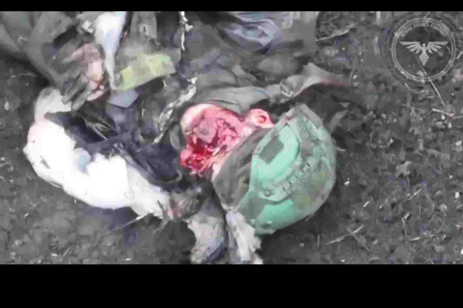 Drone Strike Tears Mans Face Off