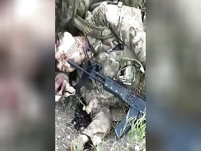 RUSSIAN SOLDIER WITHOUT BRAIN AFTER SUICIDE 