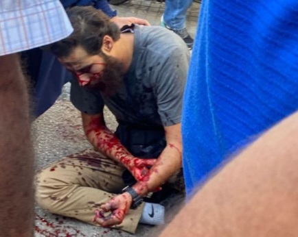 Exploding pagers injure 1,000 in likely cyberattack on Hezbollah