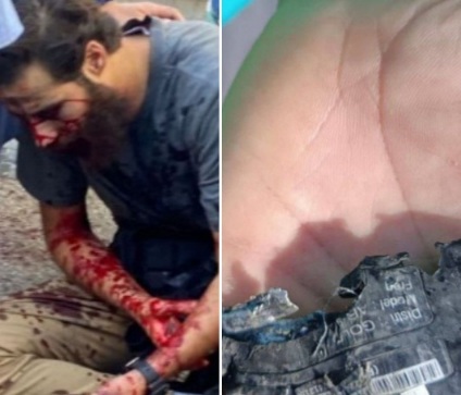 Cyber attack targeting pagers results in tens of injuries in Lebanon