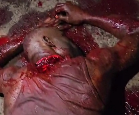 Haitian Victim of Machete Attack, nearly Decapitated still Moving
