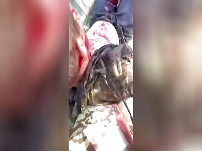 Latest Development In Shredded Zigger Transport