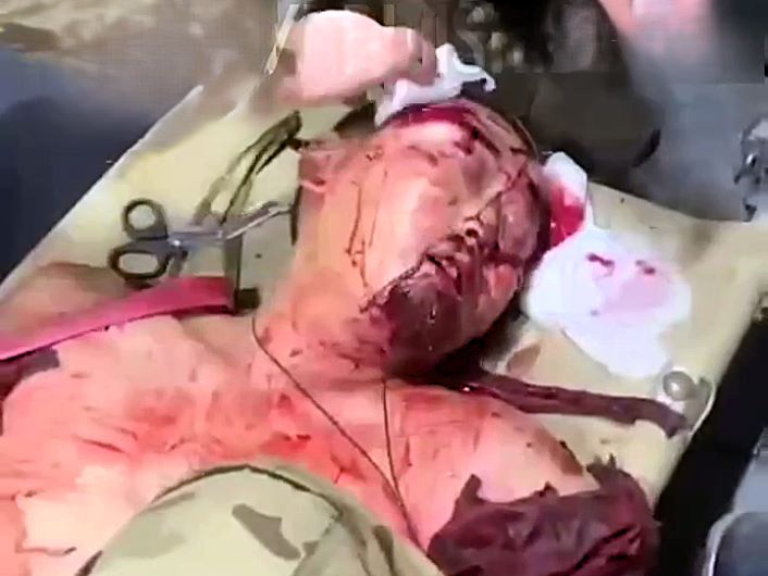 Headshot N. Korean Soldier Snores His Way to ER