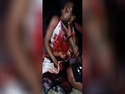 Guy's Hand Almost Severed From Machete Attack