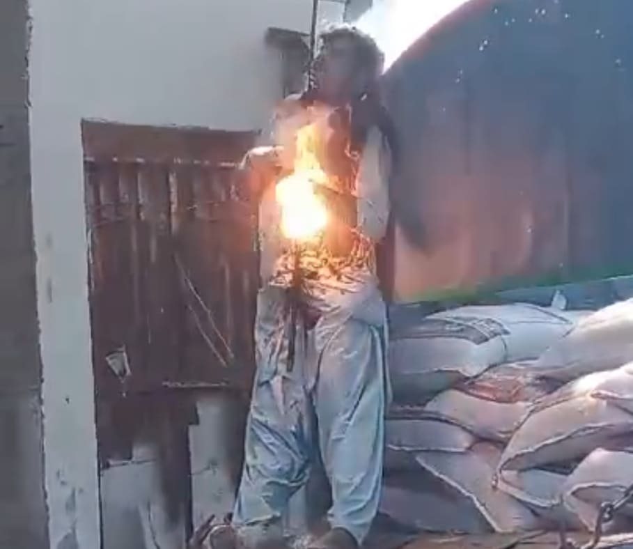 Worker Sizzles And Fries On Live Wire..